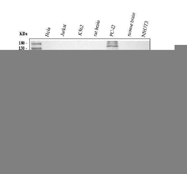 Western blot analysis of TSG101 using anti-TSG101 antibody (RP1078)