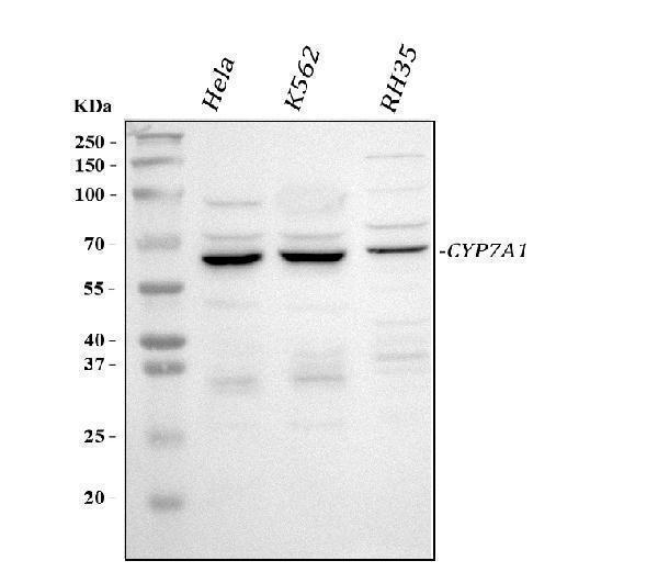  Western blot analysis of CYP7A1 using anti-CYP7A1 antibody (RP1079)