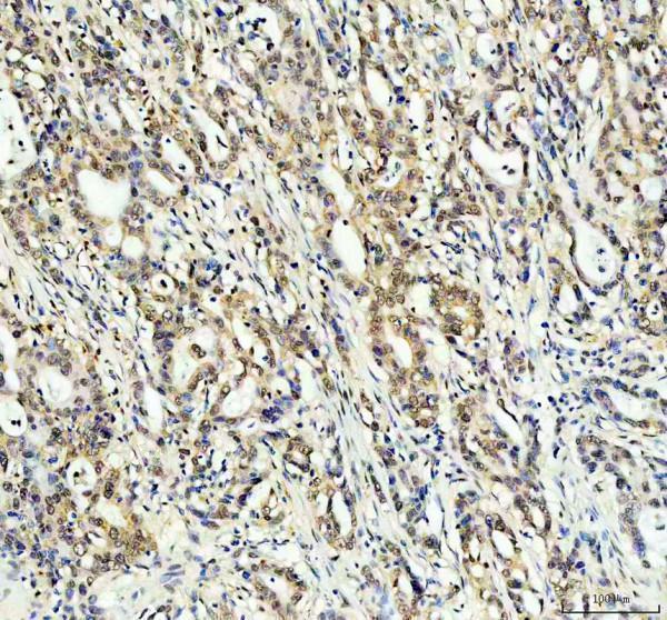  IHC analysis of KAT13D/CLOCK using anti-KAT13D/CLOCK antibody (RP1082)