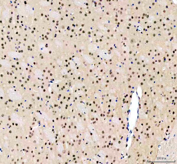  IHC analysis of KAT13D/CLOCK using anti-KAT13D/CLOCK antibody (RP1082)