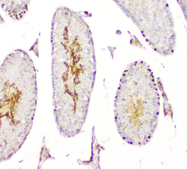  IHC analysis of DMRT1 using anti-DMRT1 antibody (RP1083)