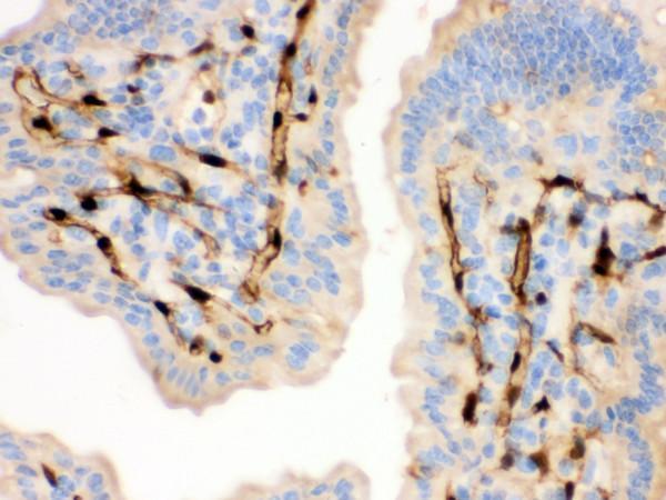 rp1085 2 ihc anti fabp4 a fabp antibody