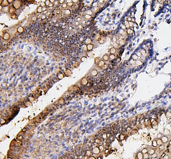 rp1086 fosb primary antibodies ihc testing 5