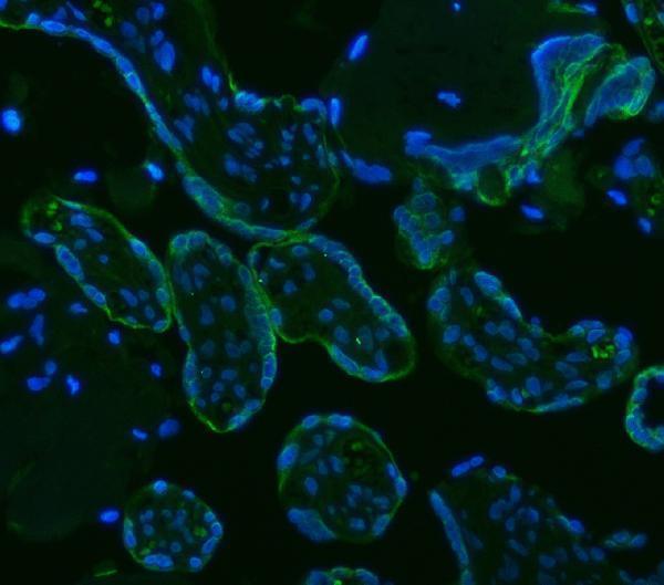 rp1094 hsd11b2 primary antibodies if testing 8