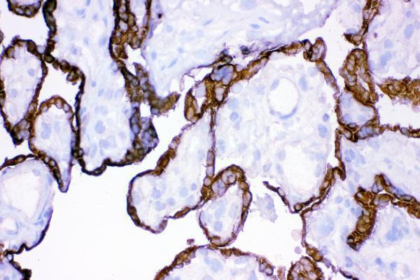 rp1094 hsd11b2 primary antibodies ihc f testing 5