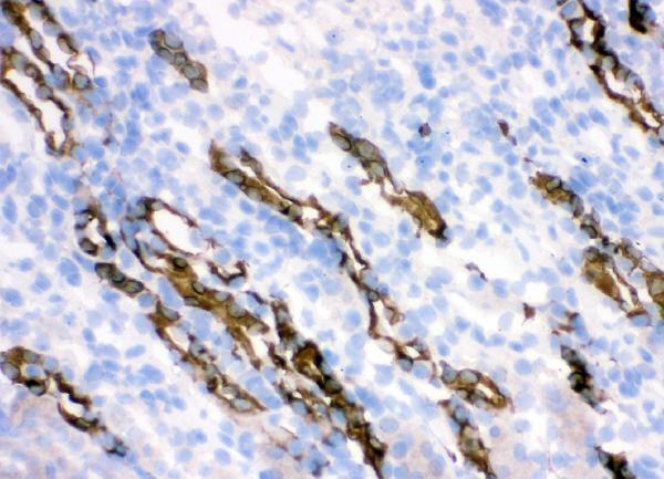 rp1094 hsd11b2 primary antibodies ihc f testing 6