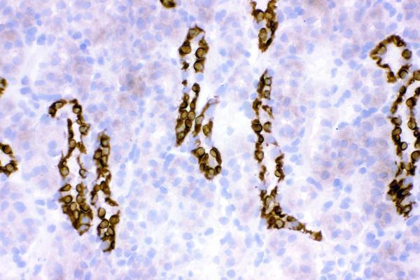 rp1094 hsd11b2 primary antibodies ihc f testing 7