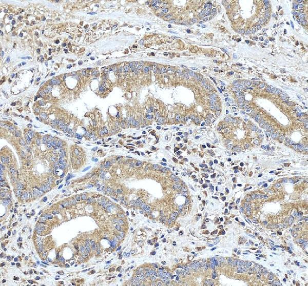 rp1099 hras primary antibodies ihc testing 3