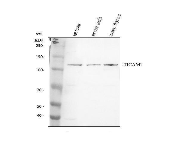 Western blot analysis of TRIF/TICAM1 using anti-TRIF/TICAM1 antibody (RP1100)