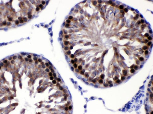 rp1104 3 ihc anti cacybp siah interacting protein antibody