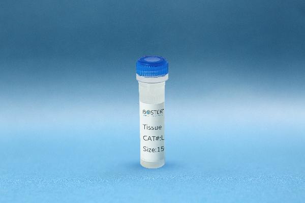 tissue protein lysate_2