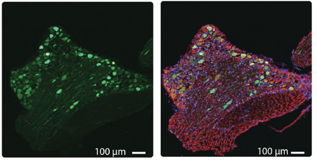 egfp-expression-and-b-tubulin