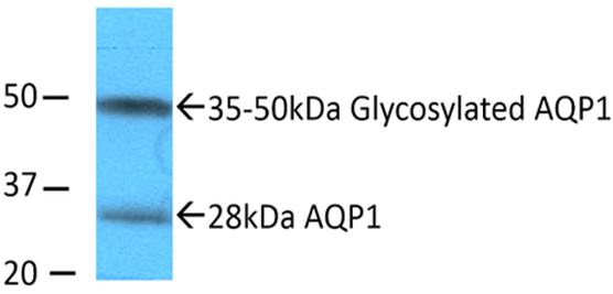  Western blot band size prediction illustration