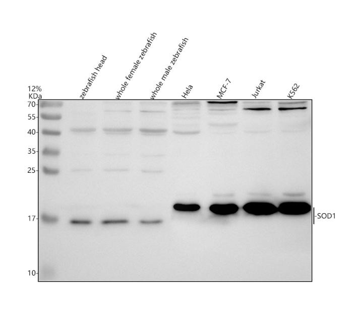 Western blot of SOD1 with PA1345