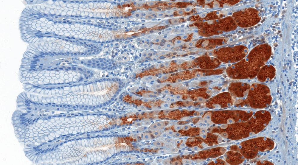 hero assay ihc 