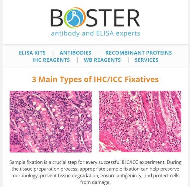 3 main types of IHC ICC fixatives newsletter thumbnail