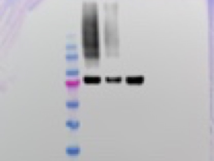 Testimonial by Svetlana Dzitoyeva on antibodies