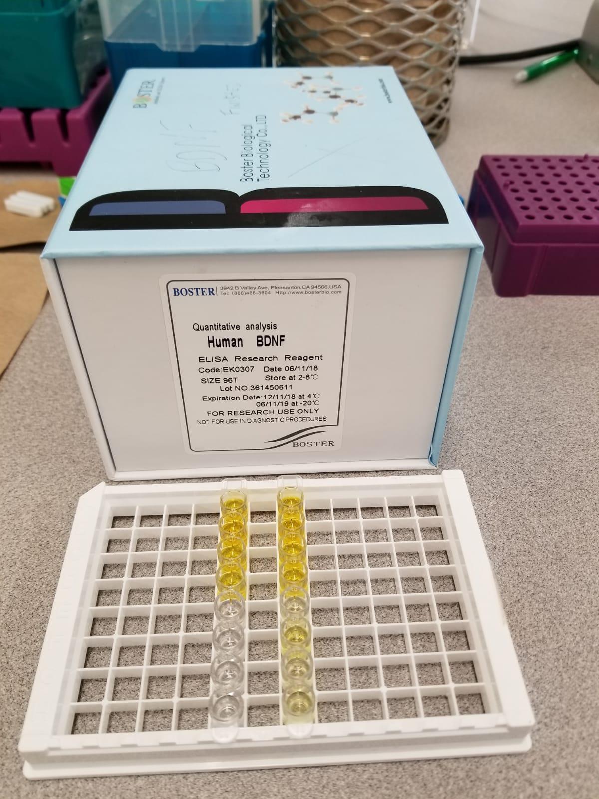 Sanjay Arora testimonial for BDNF ELISA kit