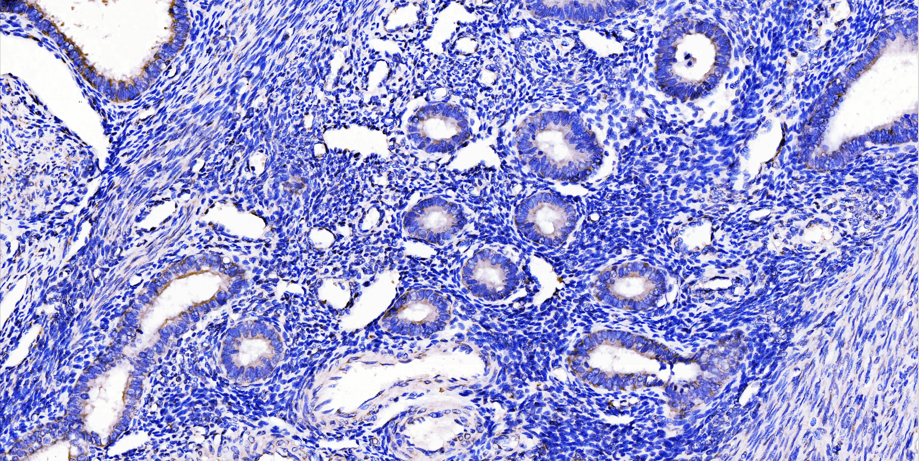 Counterstains in Immunohistochemistry: Principles, Options, and Troubleshooting
