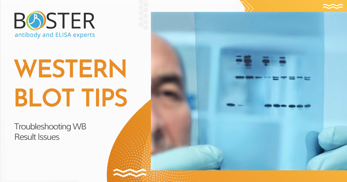 Common Troubleshooting Tips for Western Blot Results
