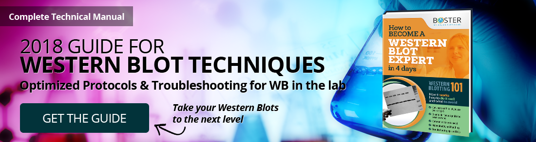 Western Blot Tips and Tricks: Blocking Optimization