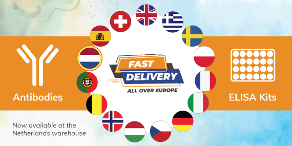 Our new warehouse in Europe