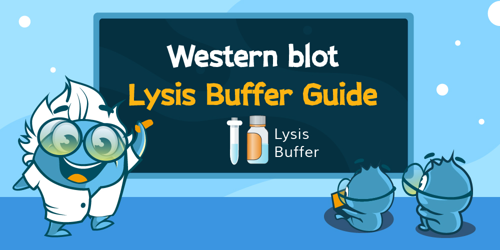 Which lysis buffer should I use for Western blot?