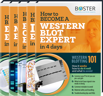 Troubleshooting guides for macrophage marker protocols