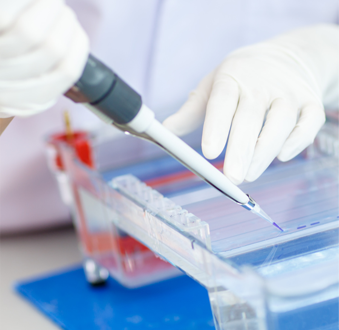 Western blot protocol for macrophage markers