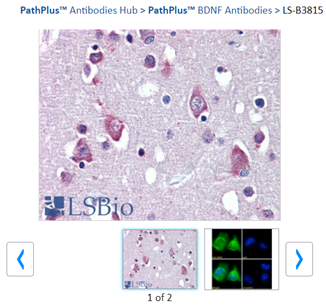LSBio BDNF antibody product image without Western blot validation