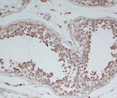 BDNF antibody screening and validation comparison image